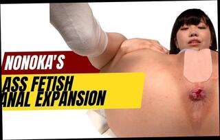 Video 1662706011: dildo anal fingering, dildo fingers ass, anal dildo fetish, expansion fetish, fingers big dildo, big dildo anal sex, anal dildo pleasure, anal dildo experience, anal dildo close, asian anal dildo, japanese anal dildo, anal dildo hd, straight dildo, dildo explores, secret dildo, intimate fingering