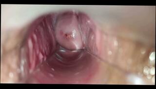 Video 1664314915: speculum orgasm, pussy speculum, orgasmo vaginal, pussy female orgasm