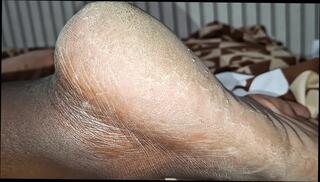 Video 1656220621: cuckold wife bbc, amateur cuckold bbc, cuckold sharing wife's ass, cuckold dirty wife, wife cuckold couple, cuckold big ass wife, cuckold bitches, black cuckold couple, cuckold licks, giant bbc wife, straight bbc, bbc pig, bbc legs, cuckold hd, large bbc, portuguese couple, wife tickle