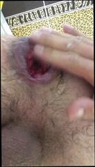 Video 336899901: dildo anal fisting, gay fisting dildo, good anal dildo, man anal dildo, anal dildo hd, prolapse, men fisting