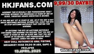 Video 1624600435: gaping prolapsed ass hole, fisting gape prolapse, dildo fisting prolapse, anal gape prolapse, pornstar anal gape, gape ass hole extrem, fisting dildo insertions, huge dildo ass, boobs dildo, anal fisting sexy, doll fisting