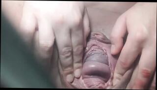 Video 1656001861: bbw dildo squirt, dildo squirting pussy, bbw squirting amateur, huge dildo squirt, big dildo squirt, open pussy squirt, squirting snatch, squirting vagina, squirting cunt, squirting twat, nude dildo, squirting straight, bottle squirt, one squirt, squirt time, squirt hd, stretched spread pussy, pussy first time