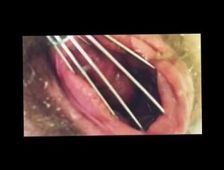 Video 1592619893: pissing peeing fetish, solo pee fetish, hairy pussy solo masturbation, hairy pussy pumped, pussy gaped pissed, hairy pussy bondage, bondage fetish hardcore, gaped pissed extreme, solo female pissing, hairy pussy masturbation orgasm, amateur hairy pussy masturbation, hairy big pussy masturbation, inserts pussy pump, pumped pussy lips, huge pumped pussy, bizarre piss, inside cunt, open pussy