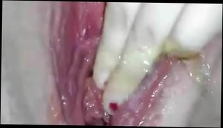Video 401257201: bbw fingers pussy, pussy fingering cunt, fingering pussy masturbation, girl fingering masturbation, fingering masturbation amateur, masturbation bbw fat, pussy fingering hd, fingering straight, cunt ruined