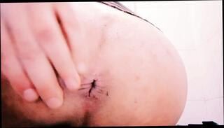 Video 1658403151: gaping ass hole fingered, pov gaping ass, solo ass gape, fingering anal gape, solo fingering hot, mature solo fingering, gaping boy ass, gay gaping ass hole, nice ass solo anal, sexy ass fingering, straight guy ass finger, gaping open ass hole, gaping creamy ass, gaping white ass, cute boy fingering, ass gaping european, ass pov hd, nude fingering, european soft solo, dick ass, romanian cute boy