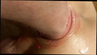 Video 1285008201: gaping fisting anals, amateur anal gape, gay anal gape, gaping deep anal, anal gape hd, gape young, gay fisting old