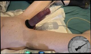 Video 1665560881: solo gay uncut cock, uncut pumped cock, big uncut cock solo, uncut dick solo, solo sex machine, skinny boy solo, pump bdsm, homemade penis pump, penis pump cum, thick uncut cock cum, pumping sex toy, huge cock solo cum, white skinny gay boy, skinny young boy gay, extreme penis pumping, uncut european cock, uncut british cock, homosexual uncut, nude uncut, pump training, machine hd