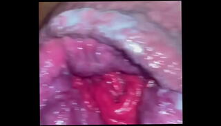 Video 1592505035: man gay