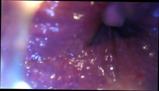 Video 1607056423: pov amateur twink, fetish twinks anal, twink anal solo, gay twink fetish, twink solo ass, vore pov, solo male pov, pov anal toy, giant vore, insertion pov, pov camera