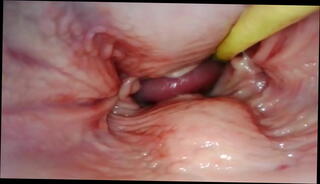 Video 1625965025: ass gaping anal creampie, anal creampie cum fart, gaping ass hole creampied, gape pussy fart, squirting gaping ass, gape creampie fuck, squirt hard fucking creampie, squirting orgasm creampie, cumshots creampie squirting, booty fucked creampied, creampie multiple squirt, gaping big booty, creampie huge squirting, gaping ass fucked slut, anal sex ass gaping, anal gaping fuck whore, gaping asses wet pussies, sex perfect gaping asses, orgasm tight pussy creampie, ass big booty bubble, big titted booty ass, gaping pink ass hole, creampie huge cum load, gaping destroyed ass, anal gape queen, gaping mature pussy, passionate creampie sex, romantic sex creampie, wild squirting orgasm, small squirting pussy, fast creampie, sensual creampie, amazing pov, cum filled pussy, cum inside pussy, camera inside pussy
