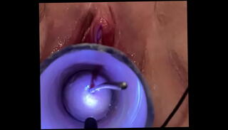 Video 1132195625: inserts speculum, masochism, clit penetration