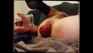 Video 1379831465: anal prolapse pump, anal fisting prolapse, anal prolapse fucking, pumped deep anal fucked, prolapsed ass fucked, extreme anal prolapse, ass hole pumped, pumped hardcore, pumping sex, insertion prolapse