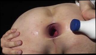 Video 42539901: wide open, gaping fisting ass holes, gay gaping ass hole, gaping ass hole anal, gaping butt hole, gaping man, giant ass hole