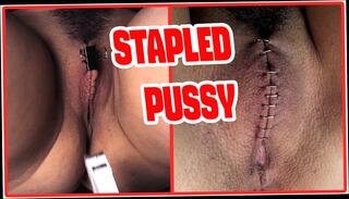 Video 1624310381: bdsm slave submission, bdsm slave punishment, bdsm fetish slave, hairy pussy punished, submissive slave slut, submissive slave girl, submissive teen slave, hardcore bdsm punishment, doctor punishment, extreme bdsm submissive, bdsm rough punishment, hairy pussies straight, hairy pussy close, hairy pussy european, old hairy pussy, hairy pussy hd, doctors clinic, doctor hospital, naughty doctor, submissive 18 year old, doctor medical, submissive goth, spanish slave, gothic slut