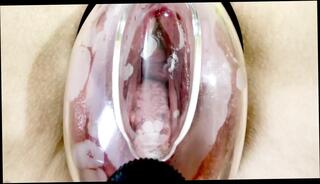 Video 1657506921: pumped pussy orgasm, pumping pussy amateur, pumped pussy close, snatch pumped, pumped vagina, twat pumped, cunt pumped, nude vagina, straight pussy, hd pussy close