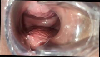 Video 1593164035: speculum masturbation, medical speculum, masturbation orgasm, masturbation close, pussy close