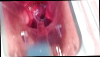 Video 821724801: speculum cum, homemade cum, homemade straight