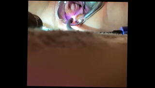 Video 1154505135: bdsm speculum, speculum orgasm, speculum masturbation, bdsm vibrators, masturbation bukkake, penetration bukkake, cum bukkake, inserts speculum, medical speculum, masochism, bdsm shaving, vibrating sound