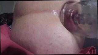 Video 1625449711: anal prolapse pump, anal pump plug, plug anal gaping, gaping prolapsed ass, anal plug solo, amateur homemade solo masturbation, gay anal plug, solo masturbation anal play, solo masturbating straight, huge anal plug, anal gape hd, solo guy masturbating
