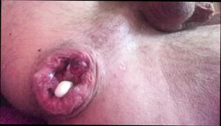 Video 1658686001: anal gape prolapse, prostate anal massage, prostate massage masturbation, solo anal gaping, gaping hole prolapse, gaping bisexual, anal gape riding, solo masturbating straight, wide anal gaping, anal gape hd, panties solo masturbation, biggest plug, british bisexual