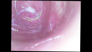 Video 1624081863: amateur orgasm solo, homemade amateur solo, vagina solo, solo female orgasm, camera solo, camera inside vagina, pussy came inside, deep inside pussy