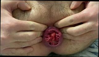 Video 1658552833: solo anal dildo fuck, anal dildo toy fetish, dildo fisting prolapse, solo male anal dildo, solo amateur dildoing, anal fucked extreme dildo, toys dildo anal stretching, deep anal dildo fucking, hardcore anal dildoing, ass fucking loving, best anal