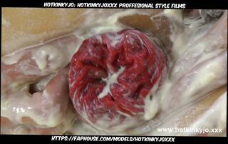 Video 1620531351: prolapse fisting fuck, anal fisting prolapse, extreme anal prolapse, big anal prolapse, prolapse masturbation, insertion prolapse, anal fucking extreme hardcore, big tits anal fisting, straight anal fucking, hardcore fuck hd