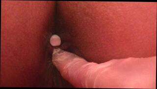 Video 1606971891: anal gaping butt plug, anal fingering butt plug, inflatable butt plug anal, gaping farting ass hole, butt plug punishment, ass fingering closeup, doctor fingering ass, anal toys butt plug, butt plug anal insertion, anal beads butt plug, butt plug girl, amateur butt plug, doctor examining straight, tight ass hole plugged, extreme butt plug, gaping ass hole close, hot gaping ass hole, ass fingering first, doctor anal exam, women farting, finger ass young, woman fingering, doctor medical exam