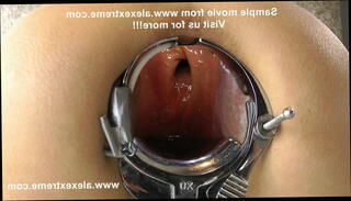 Video 1580740221: gaping anal speculum, gaping ass anal, deep anal gaping extreme, inserts speculum, speculum exam, straight anal