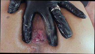 Video 1601501975: gaping prolapsed ass, gaping prolapsed ass hole, piss drinking double anal, bbc anal gape, hogtied submissive, anal gaping cum swallowing, throat bbc swallow cum, girl gaping ass hole, anal gape deep throat, balls deep anal gapes, sexy gaping ass, ass big anal gapes, cock bbc deep throat, piss facial cum, gaping anal orgasm, dick pissing cumming, anal gape cumshot, piss swallowing lover, gaping destroyed ass, anal gape queen, gaping fat ass, double anal triple, pissing kissing, bbc cum mouth, mans piss cum