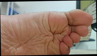 Video 1655832313: worship feet foot toes, feet foot fetish toes, foot fetish soles toes, foot worship joi, barefoot foot fetish, foot worship massage, solo male feet fetish, amateur foot worship, doctor joi, love feet toes, brunette foot worship, nurse doctor hospital, doctors clinic, pie