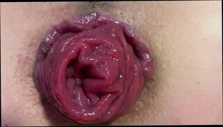 Video 1663577861: milf prolapse, ass anal prolapse, milf spreads ass, prolapsed ass holes, milf anal hd, straight milf, prolapse close