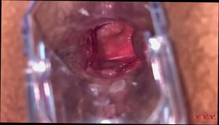 Video 1612461745: bbw anal gape, bbw big ass booty, thick booty bbw, fat booty bbw, huge booty bbw, booty slut anal, anal gaping butt, sexy bbw huge tits, homemade bbw anal, wide anal gaping, tight anal gape, huge natural tits bbw, anal speculum, huge tits mature bbw, leggings big booty