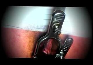 Video 298785601: toy dildo lingerie nylon, dildo toy crossdresser, speculum gaping, dildo sex toy lingerie, shemale dildos toys, dildo sex toy man, dildo masturbation toy, dildo gay toys, ladyboy lingerie nylon