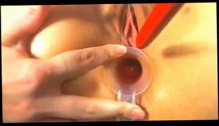 Video 195162304: teen anal cumshot, butt girl, girl self, inserts butt