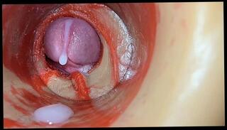 Video 1658619073: doggy style creampie compilation, doggy style pov compilation, doggy style dripping creampie, missionary creampie doggy style, amateur doggy style creampie, doggy style creampie cum, ass doggy style compilation, babe pov doggy styled, big ass pov doggy, best doggy style compilation, doggy style huge creampie, doggy style pov close, creampie ass cum inside, compilation huge cum load