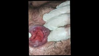 Video 1600027893: uncut twink solo, anal gape prolapse, twink gaping gay, anal gape fetish, latex fetish anal, fetish twink porn, solo amateur twink, uncut latino twink, uncut solo male, gay twink porn bear, twink gay porn first, anal gape first time, gaping destroyed ass, gaping ass stretched, gaping spread, play closeup
