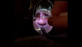 Video 1170133785: sadism masochism, pussy speculum, speculum masturbation, medical speculum, masturbating shaved pussy, fuck pain