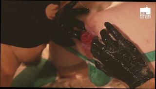 Video 1664867195: anal fisting prolapse, prolapse fisting ass, fetish anal fisting, hardcore fisting fetish, hardcore gay fetish, anal prolapse play, rough anal fetish, piercing fetish, fetish penetrating, fetish cock, fetish deep, fetish italian