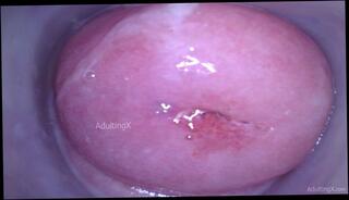 Video 1665331873: speculum pussy gape, closeup pov masturbation, closeup solo masturbation, amateur closeup pov, fetish solo masturbation, pov solo female, dirty talk solo masturbation, masturbate wet pussy closeup, hardcore pussy gaping, gaping wet vagina, dirty pov giantess, pink pussy closeup, solo masturbation deep, shrink giantess pov, camera closeup, behind closeup