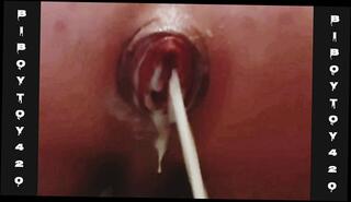 Video 1665095333: ass gaping anal creampie, anal gape prolapse, closeup anal creampie, solo anal gaping, gaping ass fetish, fetish gay solo, jock gapes, anal gaping cum, closeup amateur anal, boy solo anal, extreme anal prolapse, huge anal prolapse, solo male anal, gape cream, french jock, hot creamy cum