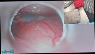 Video 1620568265: uncensored japanese creampie, doctor uncensored, uncensored japanese hardcore, cum uncensored, woman doctor, german hardcore creampie, creampie asian hardcore, doctor impregnates, doctor medical, camera creampie, crazy doctor, japanese cum inside, woman bizarre
