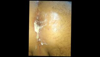 Video 1569473423: gaping farting ass hole, gape farting anal, anal gape fetish, solo anal gaping, fetish solo masturbation, gaping ass hole toyed, amateur anal gape, solo masturbation handjob, anal gape male, sexy farts