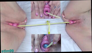 Video 1627034825: hardcore lesbian bdsm, prolapse lesbians, mature lesbian bdsm, lesbian perversions, extremely hardcore bdsm, lesbians penetrate, hardcore german bdsm, insertion prolapse, lesbian pain, lesbian pink, lesbian times