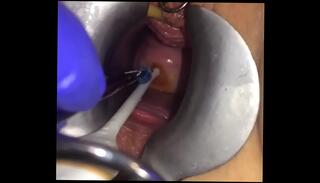 Video 1048652485: urethra play