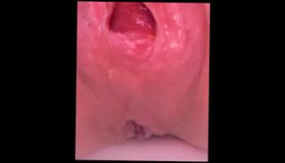 Video 1593952613: bbw foot fetish, milf foot fetish, foot fetish solo, amateur bbw milf, bbw milf big ass, foot fetish foreplay, female foot fetish, mature foot fetish, whore tight pussy, inside tight pussy