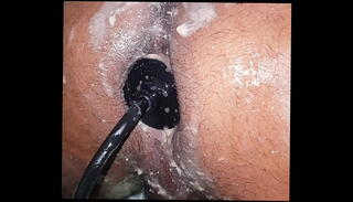 Video 1131500045: dildo anal prolapse, inflatable dildo anal, extreme anal prolapse, anal dildo training