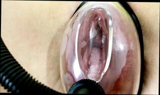 Video 1664759191: vacuum pumped pussy, pumped labia, fetish pump, pumping pussy amateur, big pussy lips labia, extreme pussy pump, vaginal pump, pussy pump playing, fetish nude, fetish straight, pump close, fetish hd, pussy destroyed