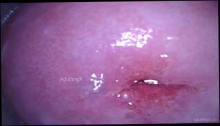 Video 1665331803: speculum pussy gape, closeup pov masturbation, closeup solo masturbation, amateur closeup pov, fetish solo masturbation, pov solo female, dirty talk solo masturbation, masturbate wet pussy closeup, hardcore pussy gaping, gaping wet vagina, dirty pov giantess, pink pussy closeup, solo masturbation deep, shrink giantess pov, camera closeup, behind closeup