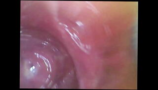 Video 1623305035: sperm pussy, cam inside pussy, orgasm inside pussy, pussy juice, women